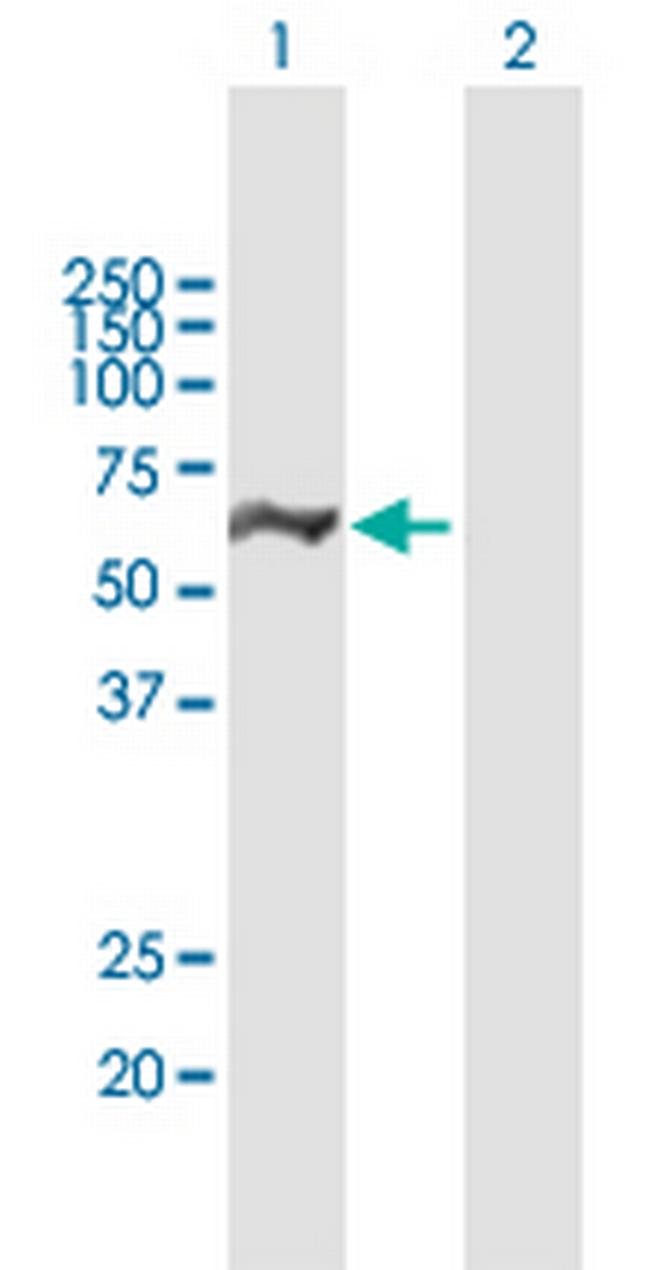 DDX19B Antibody in Western Blot (WB)