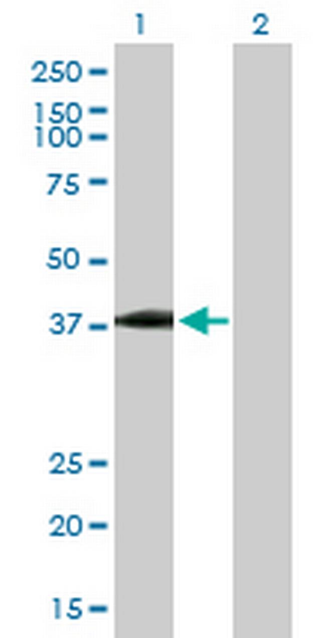 USP18 Antibody in Western Blot (WB)