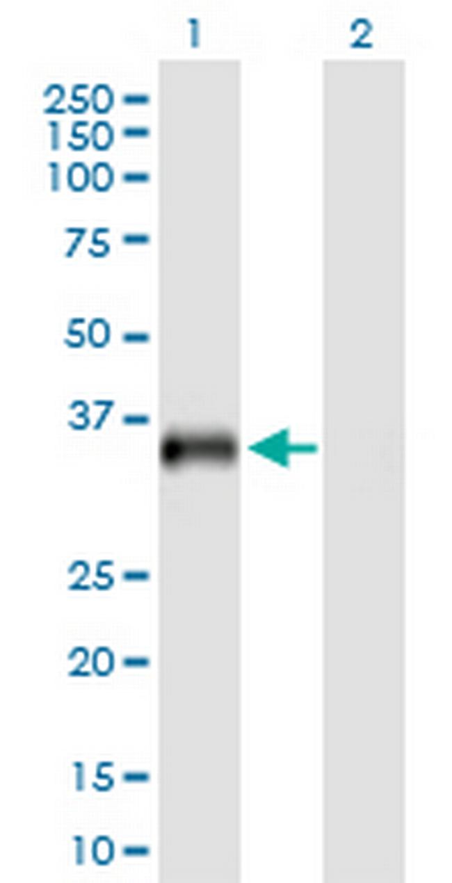 USP18 Antibody in Western Blot (WB)