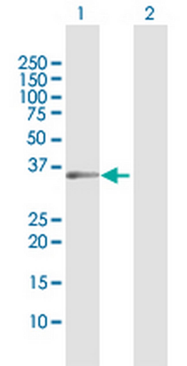 USP18 Antibody in Western Blot (WB)
