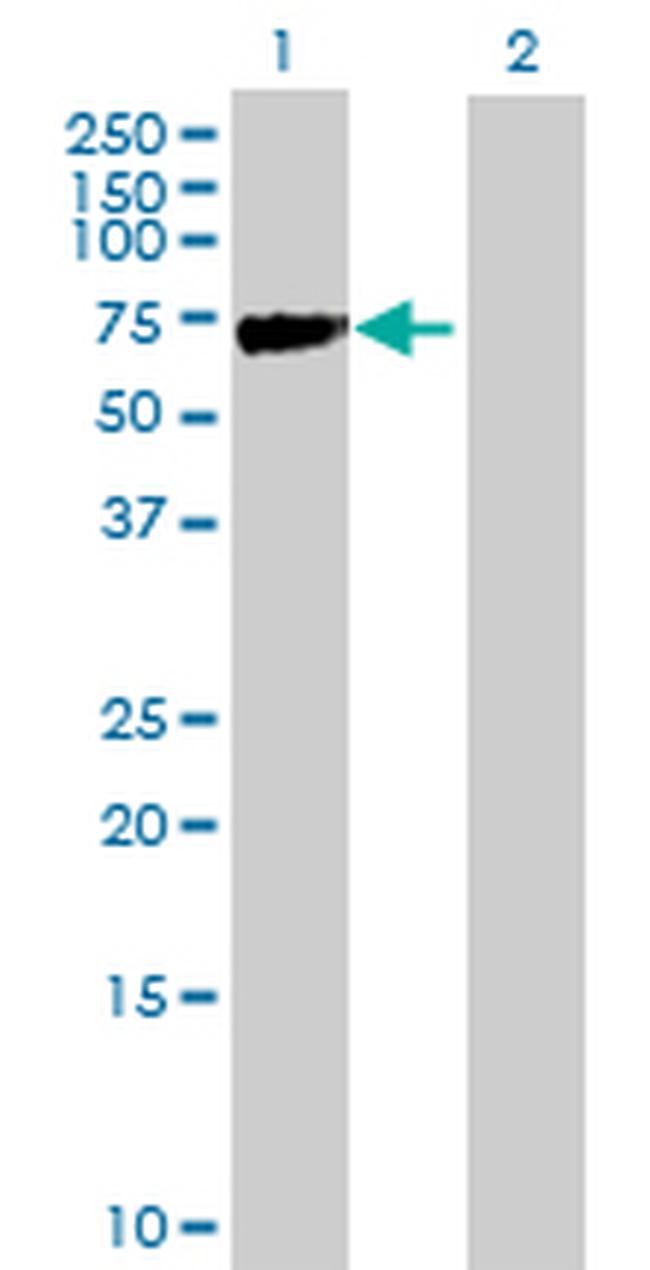 KLHL2 Antibody in Western Blot (WB)
