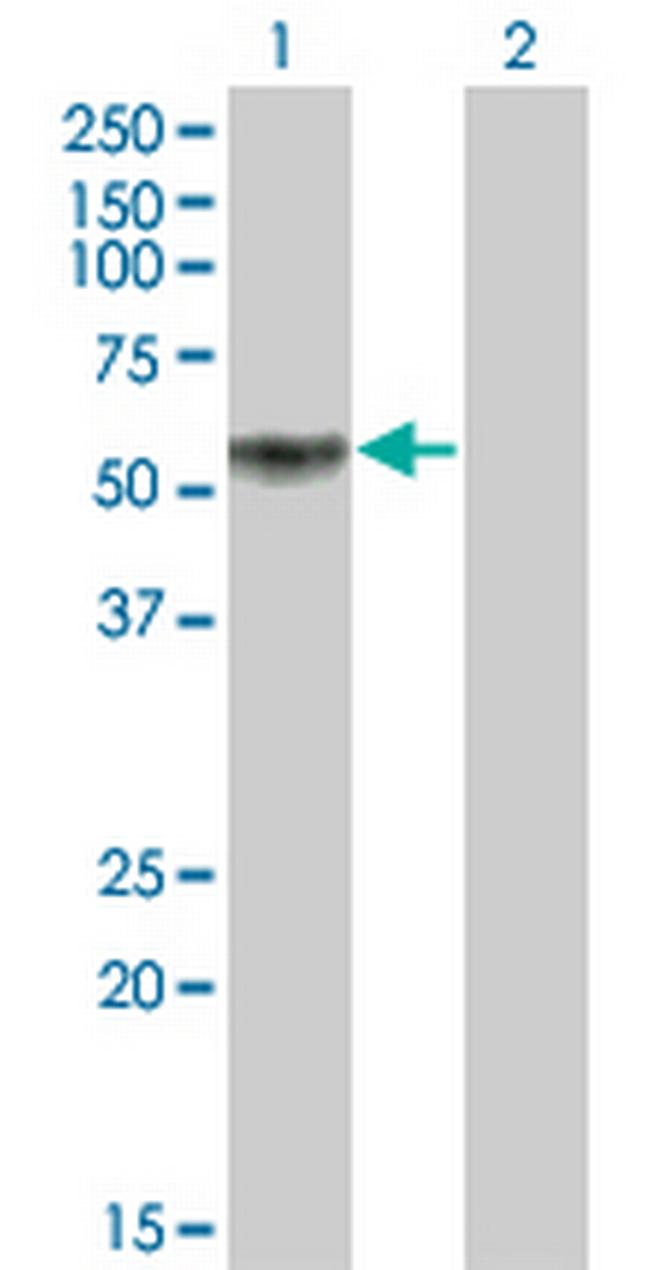 KLF12 Antibody in Western Blot (WB)