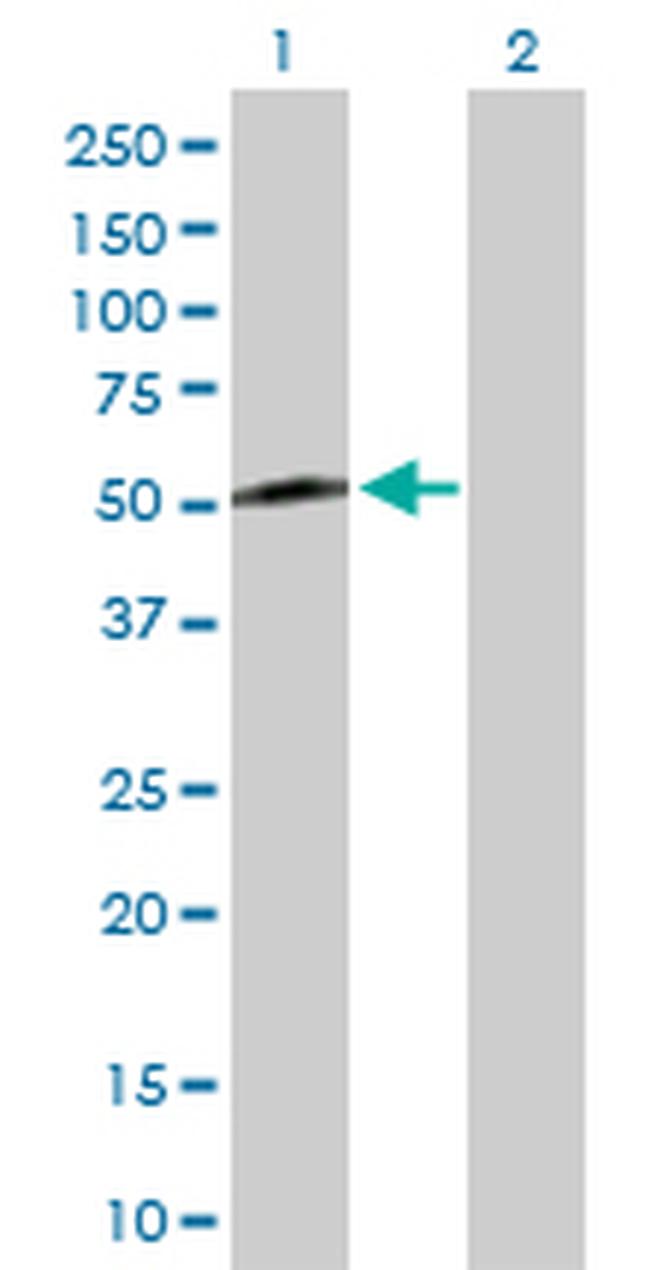 KLF8 Antibody in Western Blot (WB)