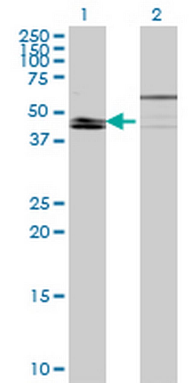 KLF8 Antibody in Western Blot (WB)