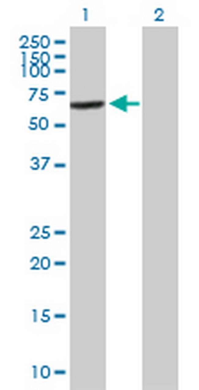 VPS45 Antibody in Western Blot (WB)