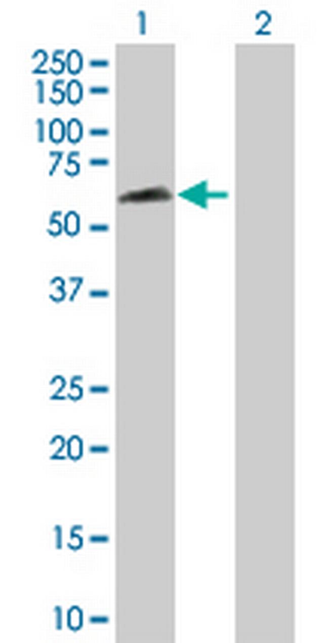 RBPJL Antibody in Western Blot (WB)