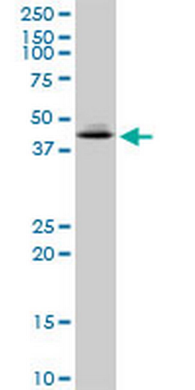 XAB1 Antibody in Western Blot (WB)