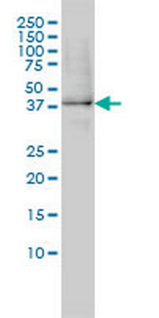 XAB1 Antibody in Western Blot (WB)