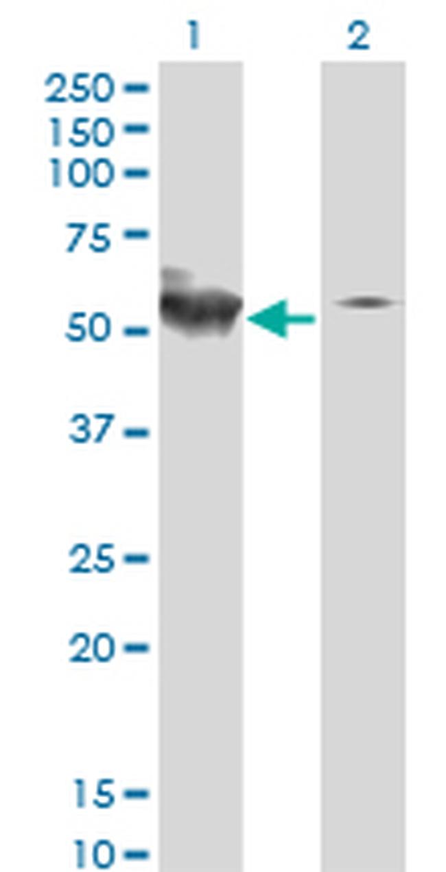 STK38 Antibody in Western Blot (WB)