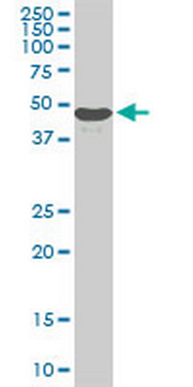 STK38 Antibody in Western Blot (WB)
