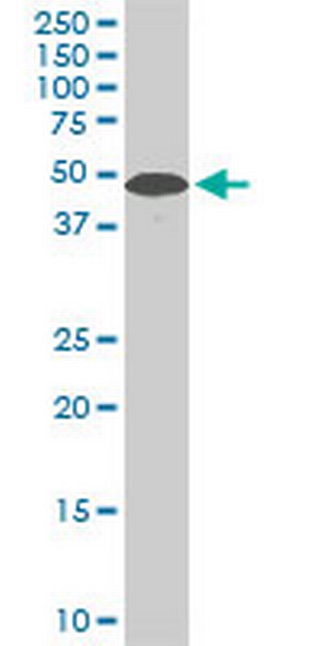STK38 Antibody in Western Blot (WB)