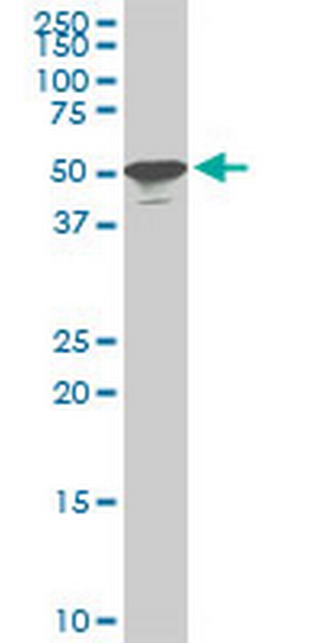 STK38 Antibody in Western Blot (WB)