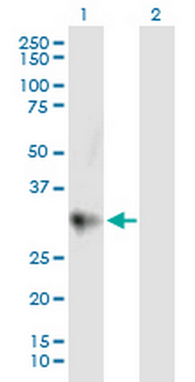 CTRC Antibody in Western Blot (WB)