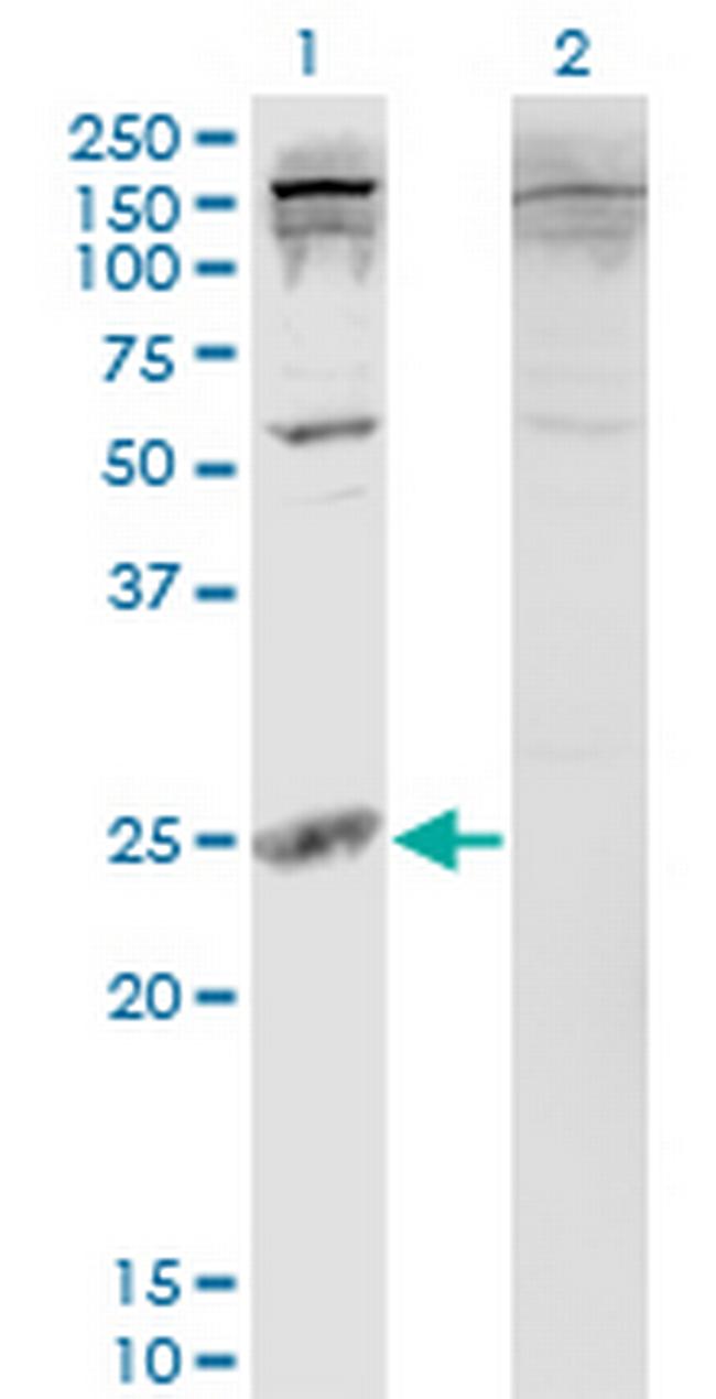 PDAP1 Antibody in Western Blot (WB)