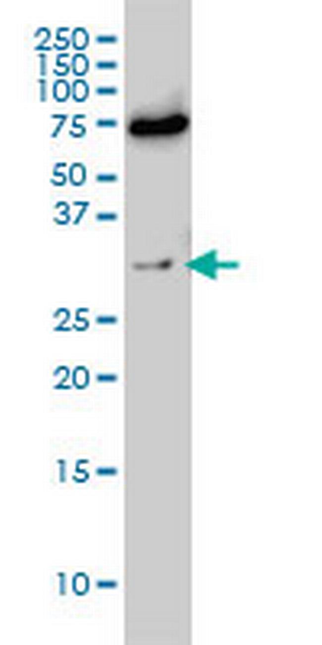 EXOSC8 Antibody in Western Blot (WB)