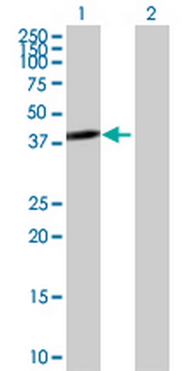 TWF2 Antibody in Western Blot (WB)