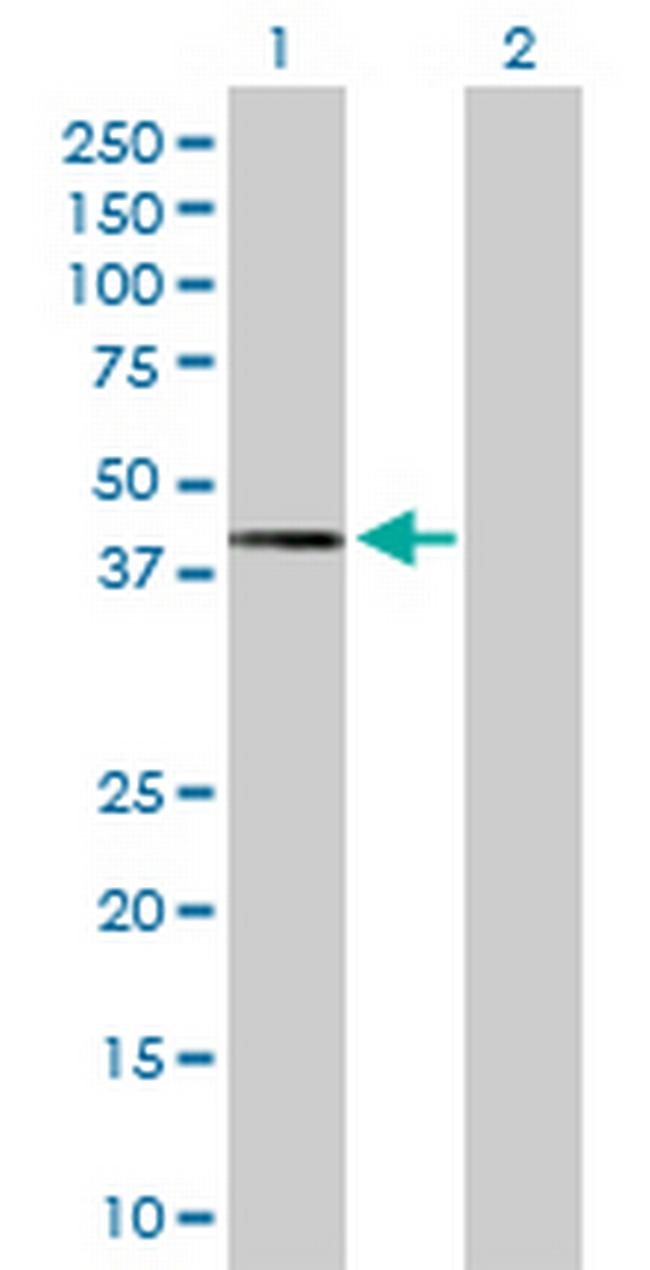 TWF2 Antibody in Western Blot (WB)