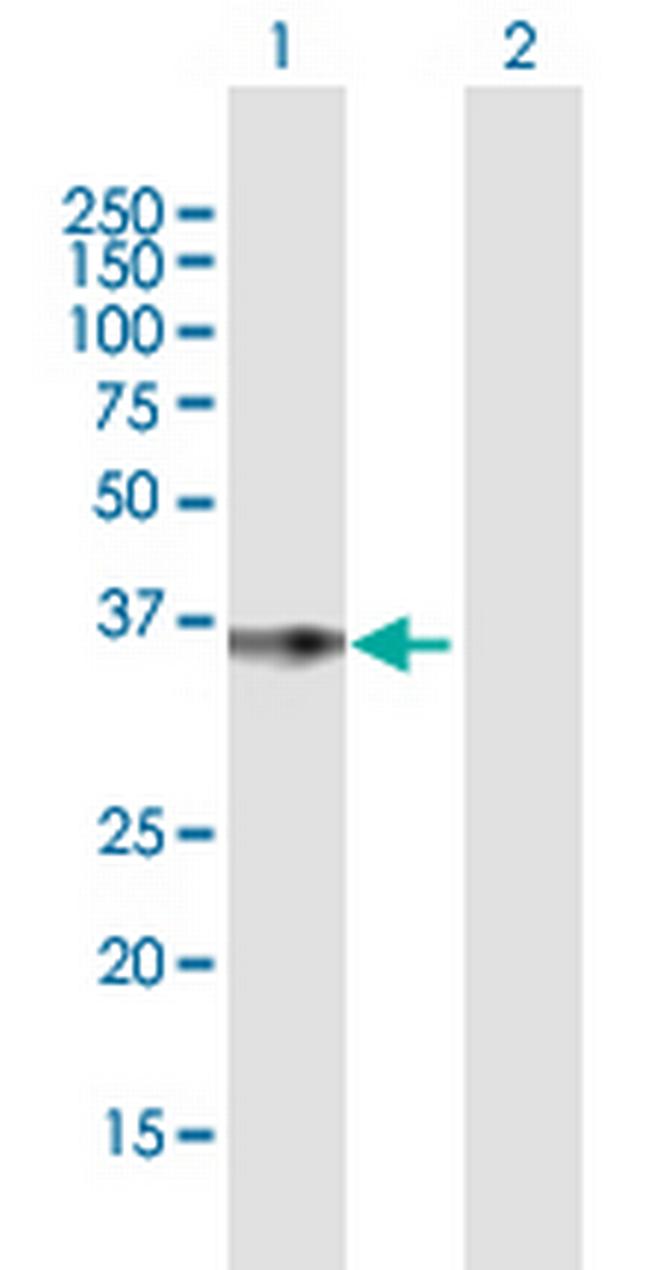 PHLDA1 Antibody in Western Blot (WB)