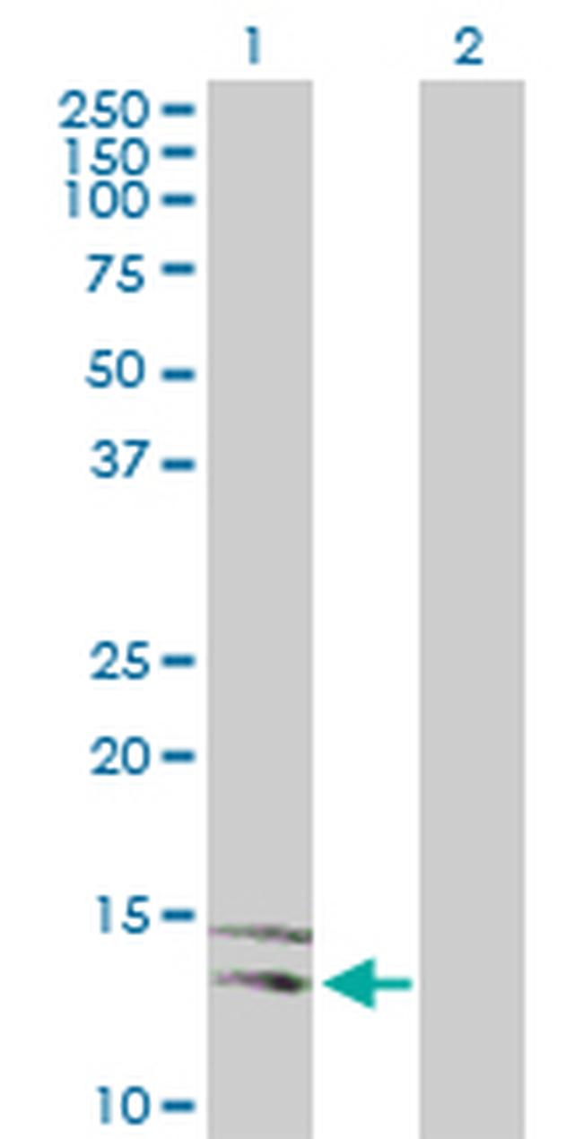 NLGN4Y Antibody in Western Blot (WB)