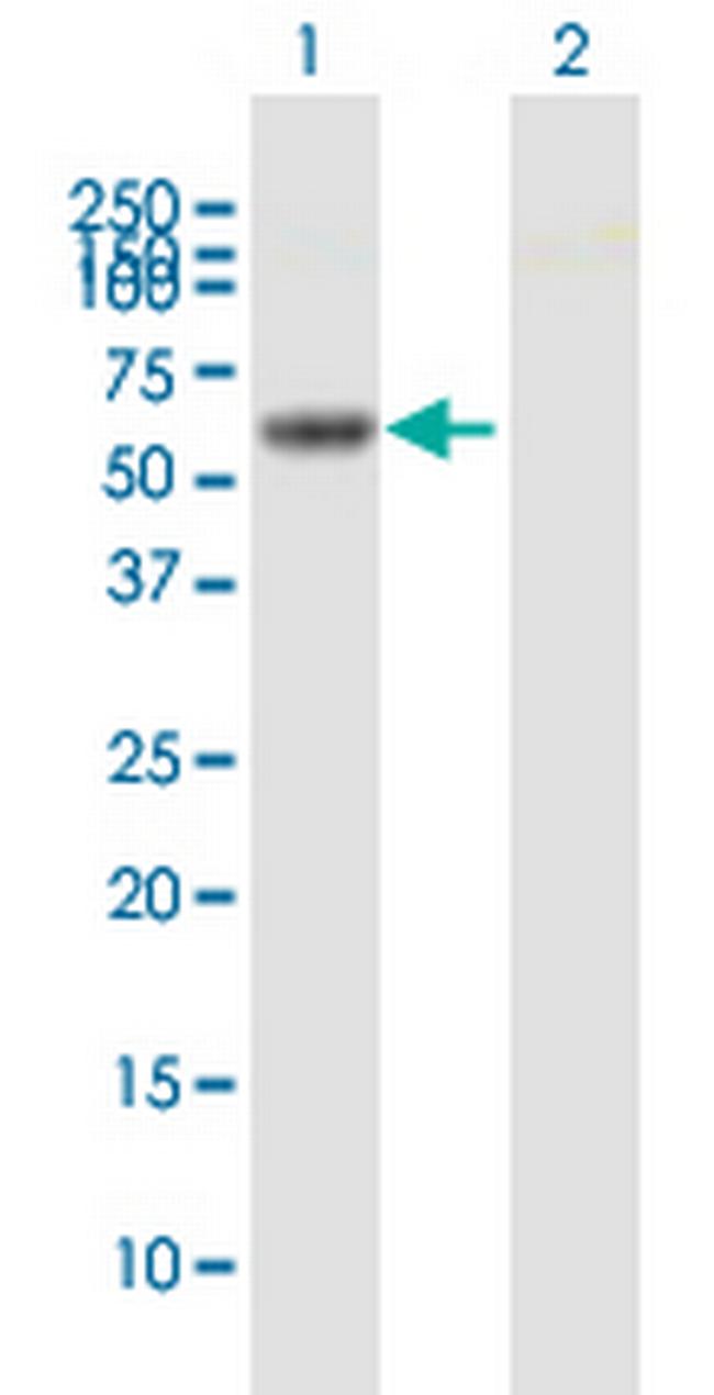 RHOBTB3 Antibody in Western Blot (WB)
