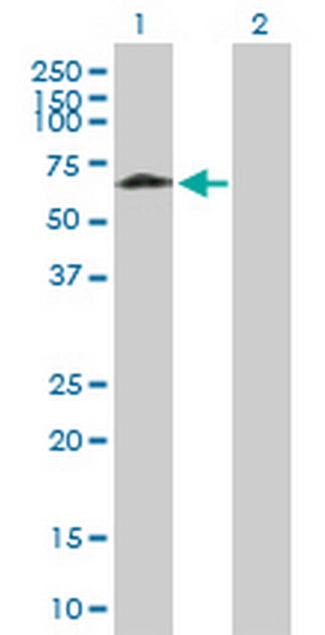 DLGAP4 Antibody in Western Blot (WB)