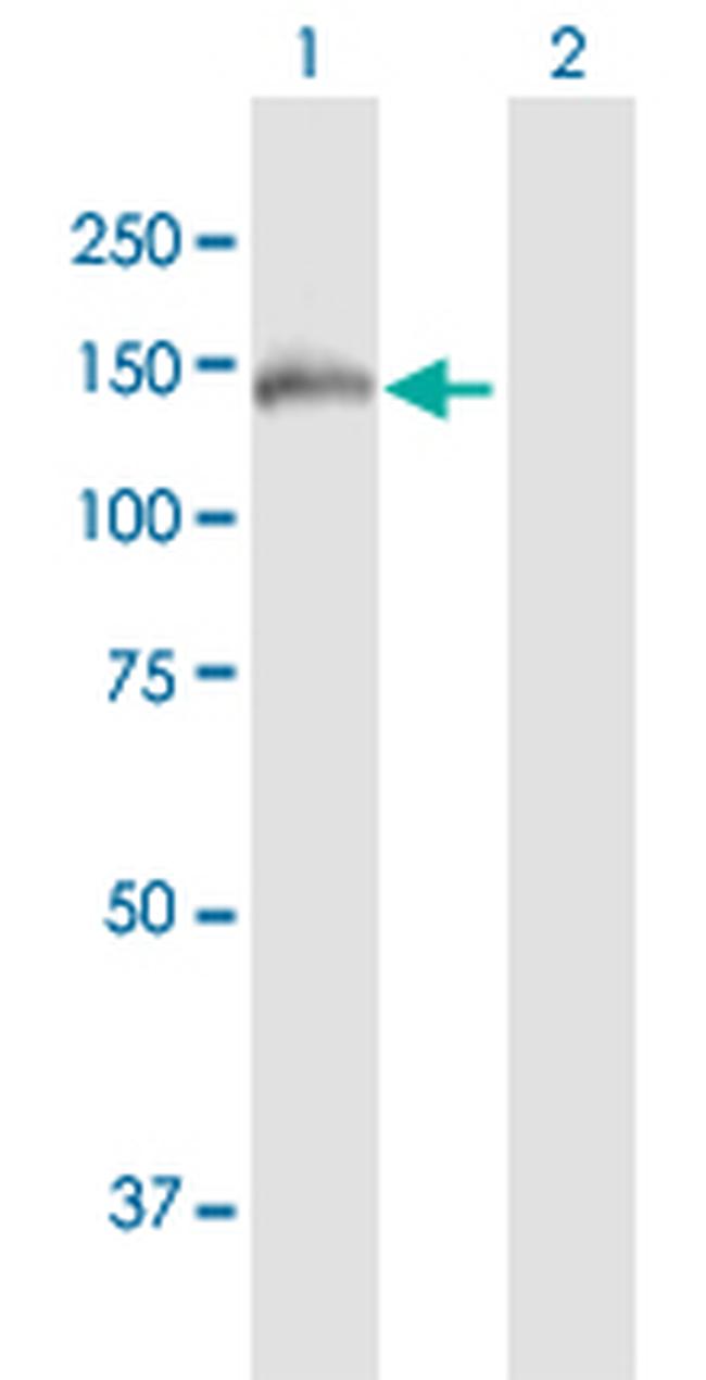 FNDC3A Antibody in Western Blot (WB)