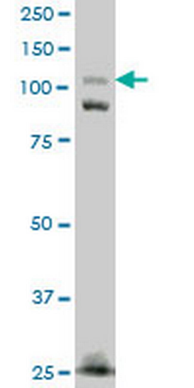 FNDC3A Antibody in Western Blot (WB)