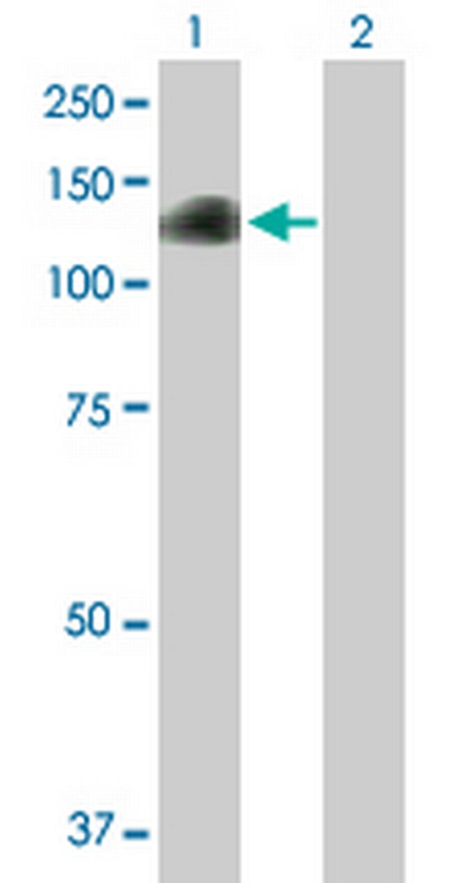 DZIP1 Antibody in Western Blot (WB)