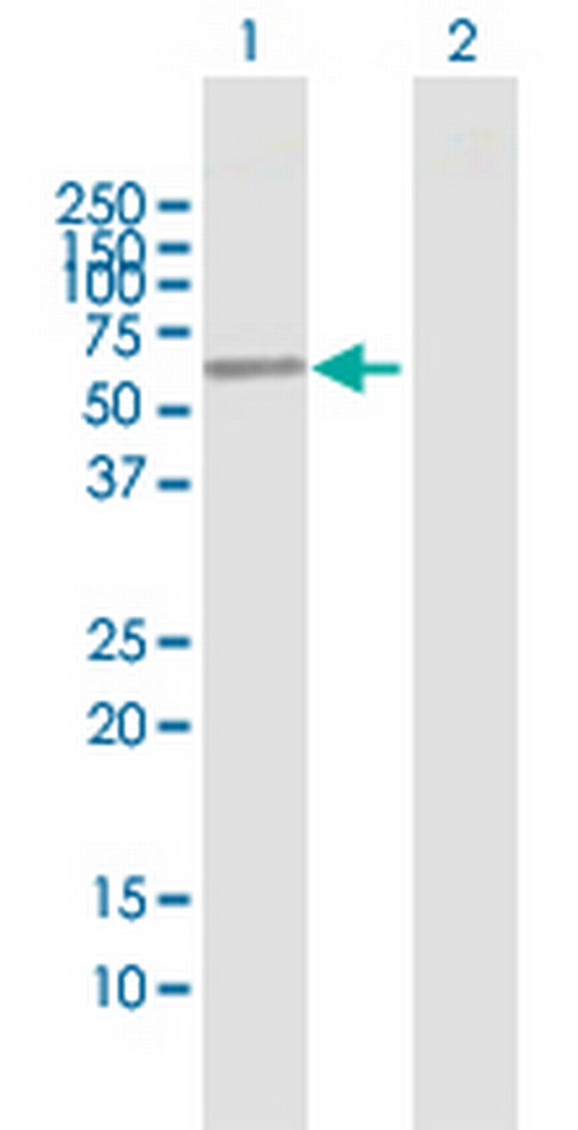ENPP4 Antibody in Western Blot (WB)
