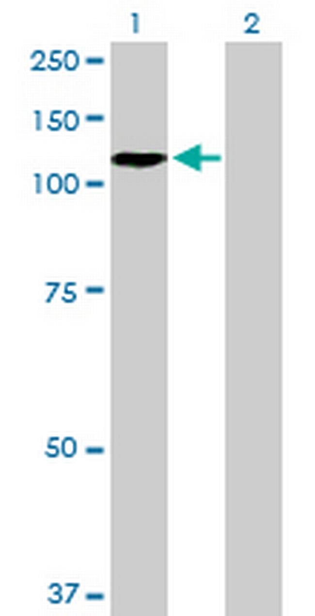 ZHX2 Antibody in Western Blot (WB)
