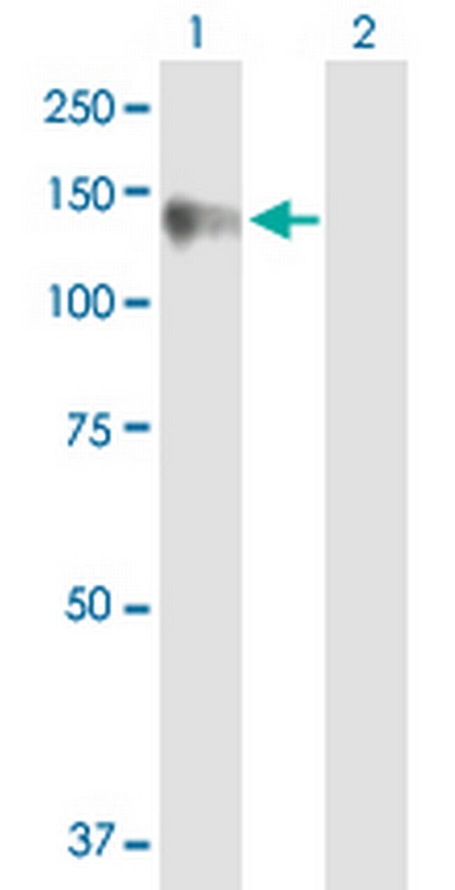 CLSTN1 Antibody in Western Blot (WB)