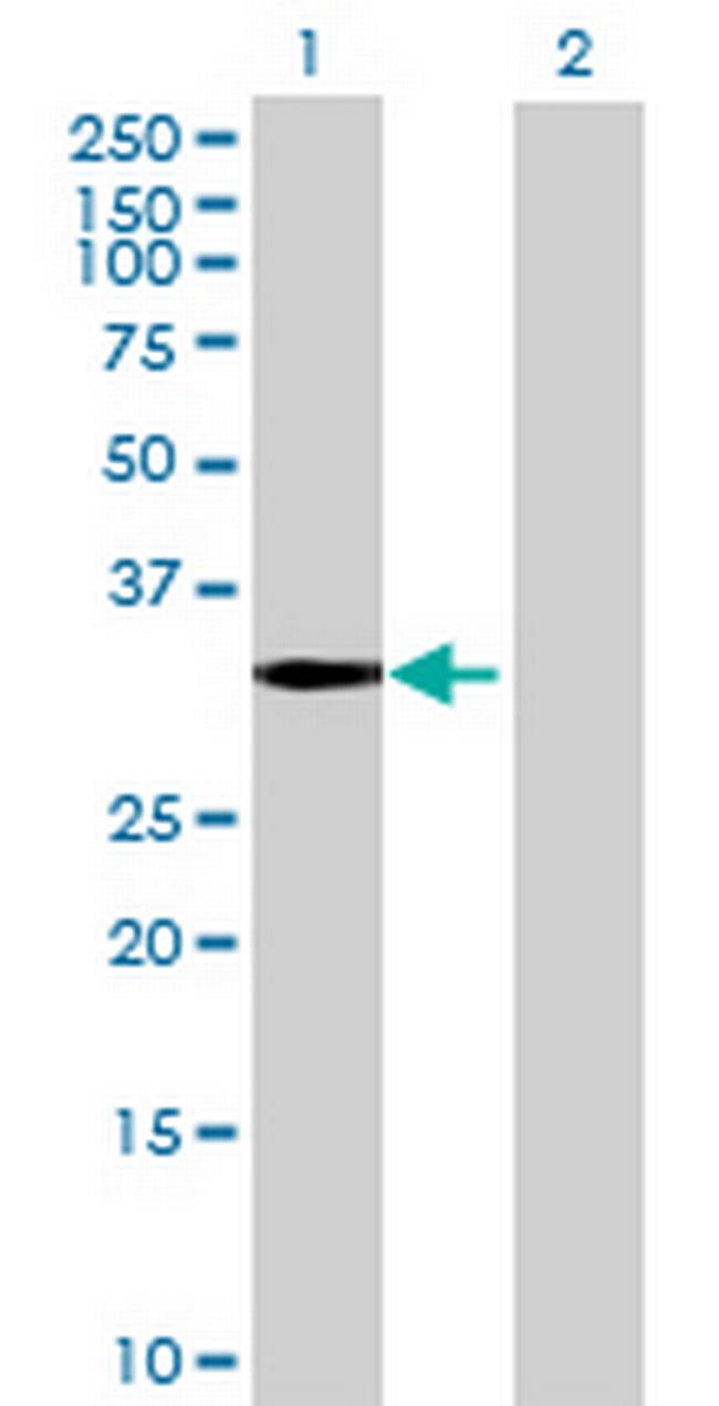ZNF365 Antibody in Western Blot (WB)