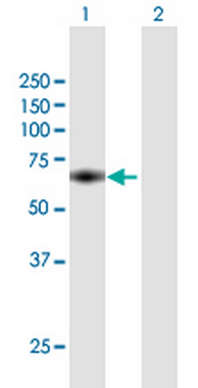 MTMR15 Antibody in Western Blot (WB)