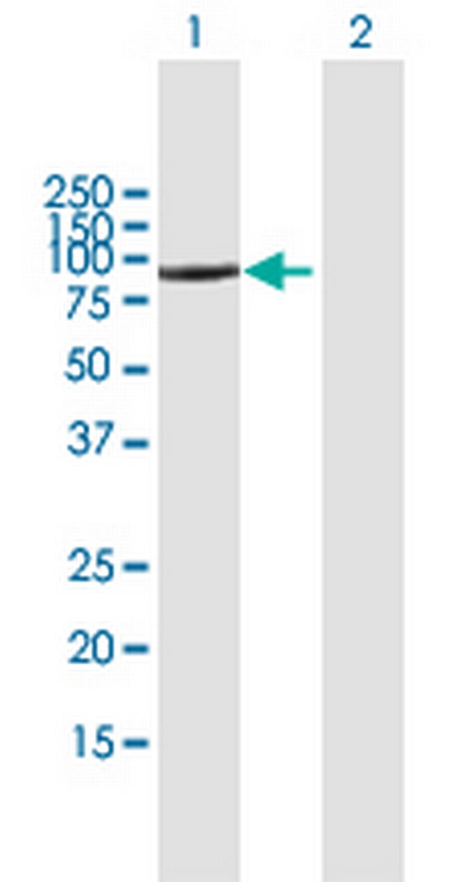 CD93 Antibody in Western Blot (WB)