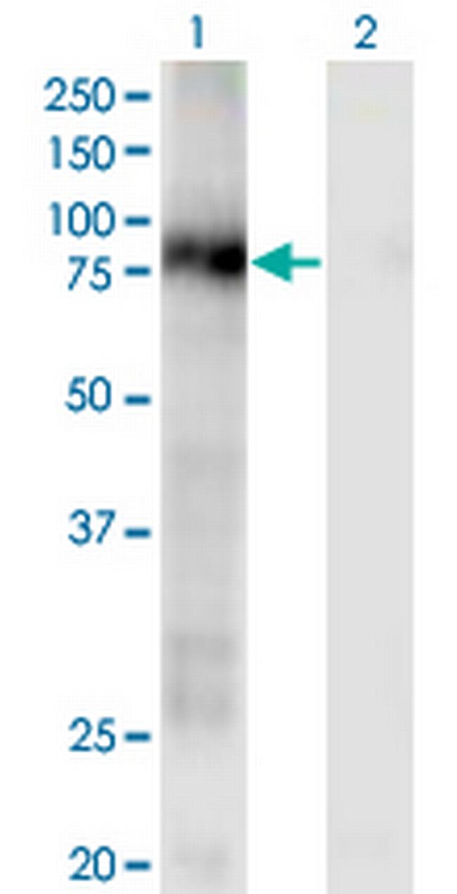 CD93 Antibody in Western Blot (WB)