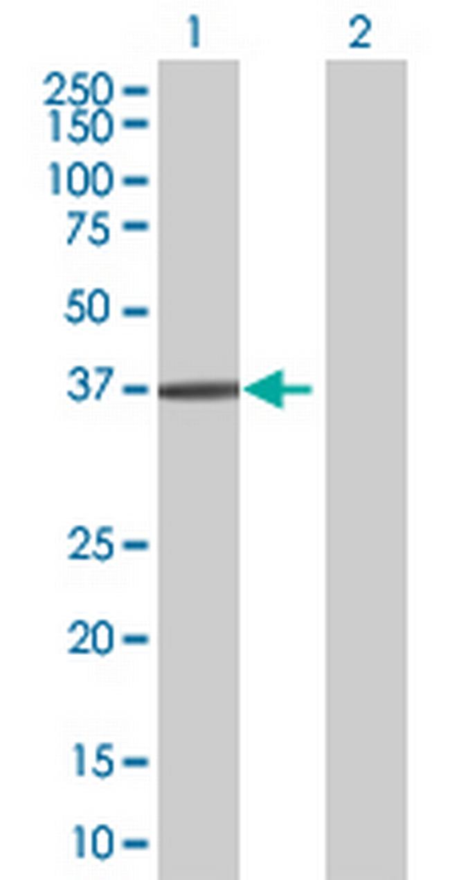 MAPRE3 Antibody in Western Blot (WB)