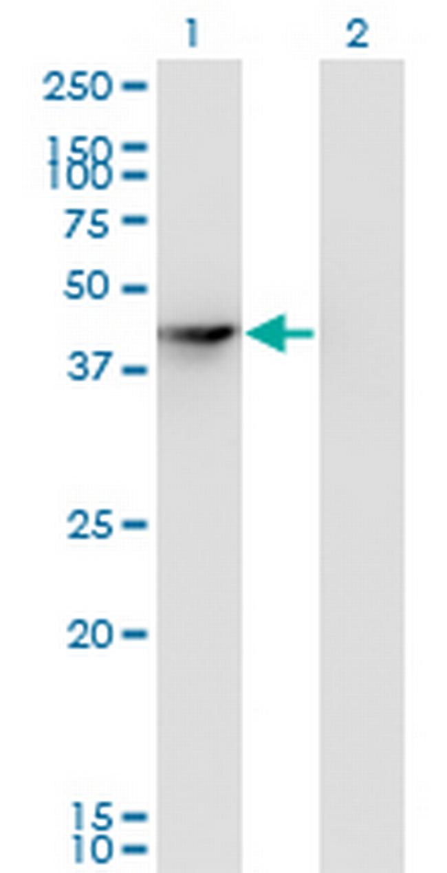 SEPHS1 Antibody in Western Blot (WB)