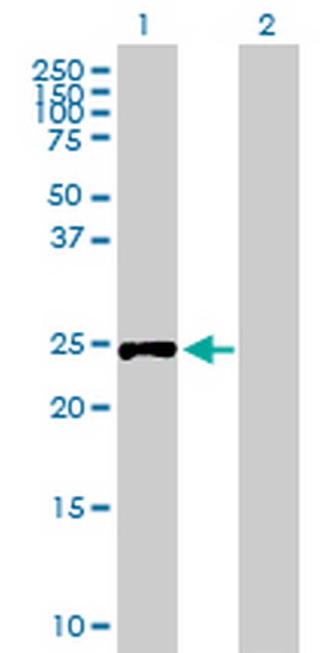 RPIA Antibody in Western Blot (WB)