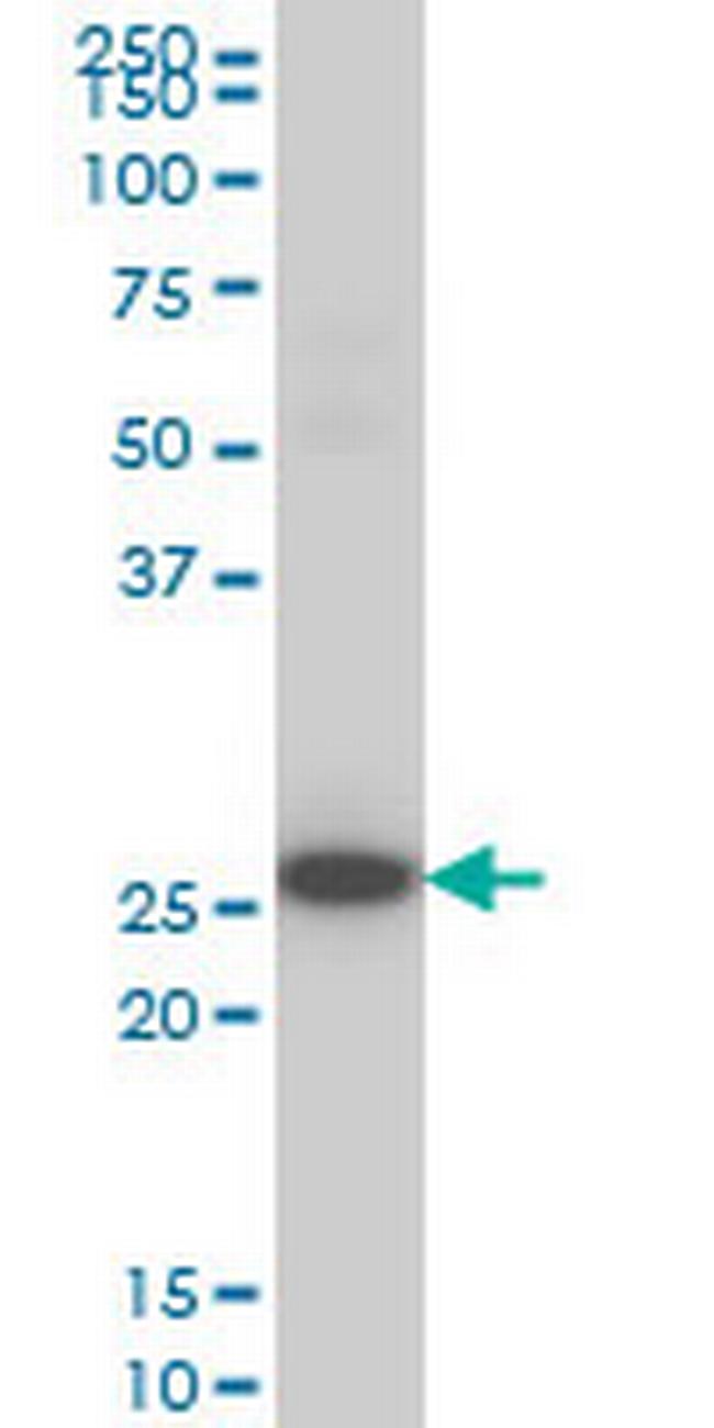 DKK1 Antibody in Western Blot (WB)