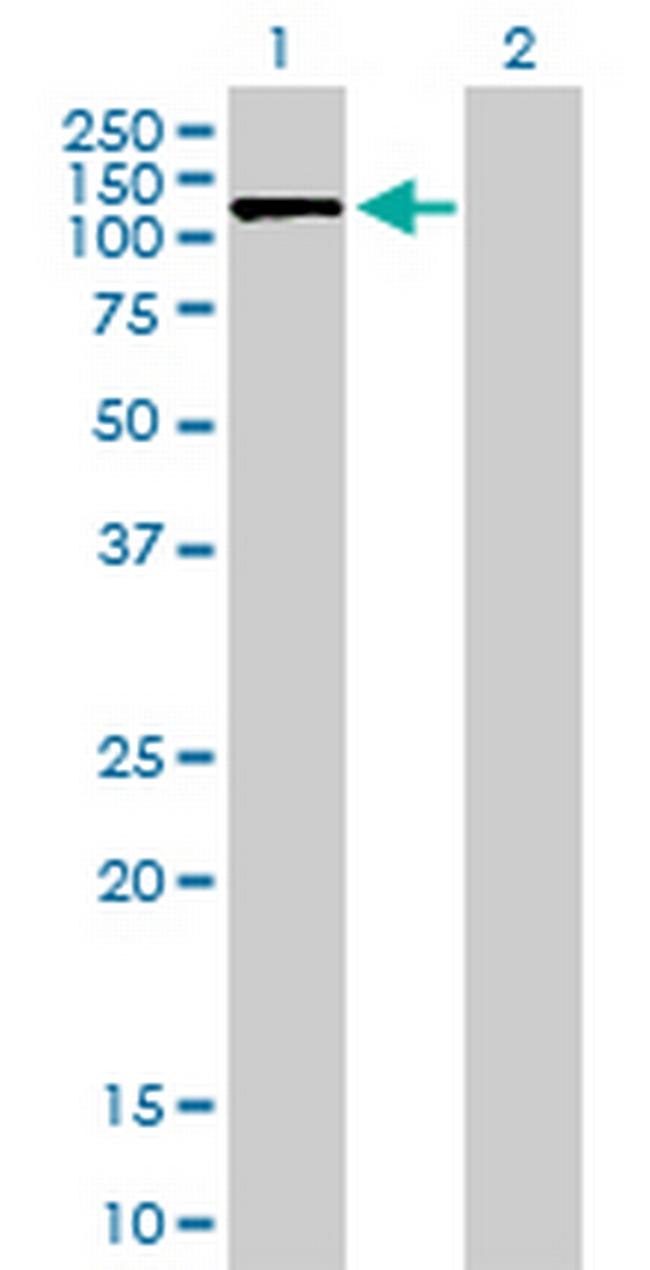 SLC4A1AP Antibody in Western Blot (WB)