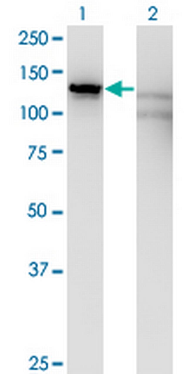 SLC4A1AP Antibody in Western Blot (WB)