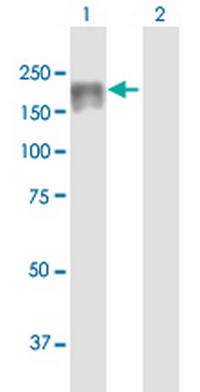DIP2C Antibody in Western Blot (WB)