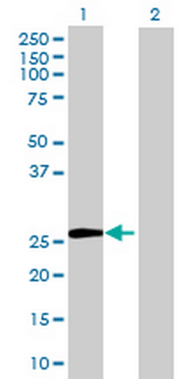 C1orf34 Antibody in Western Blot (WB)