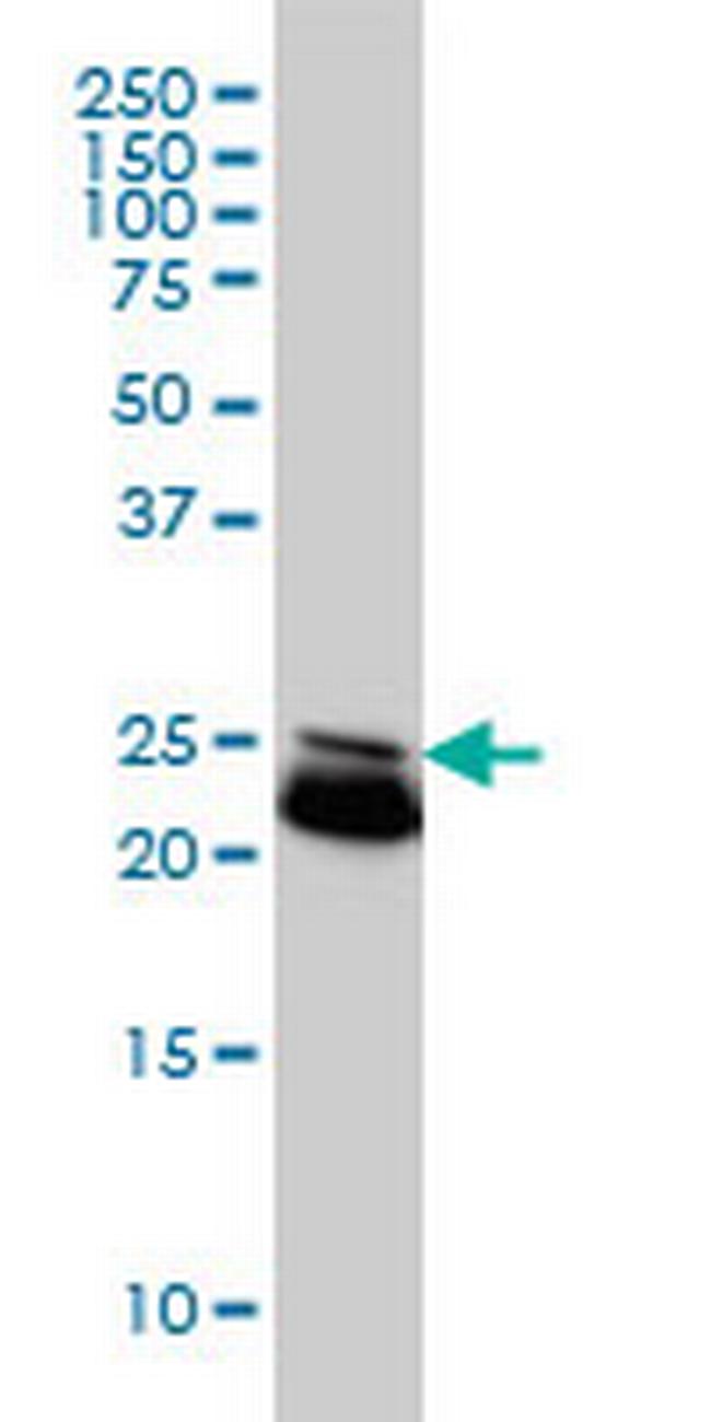 RAB21 Antibody in Western Blot (WB)