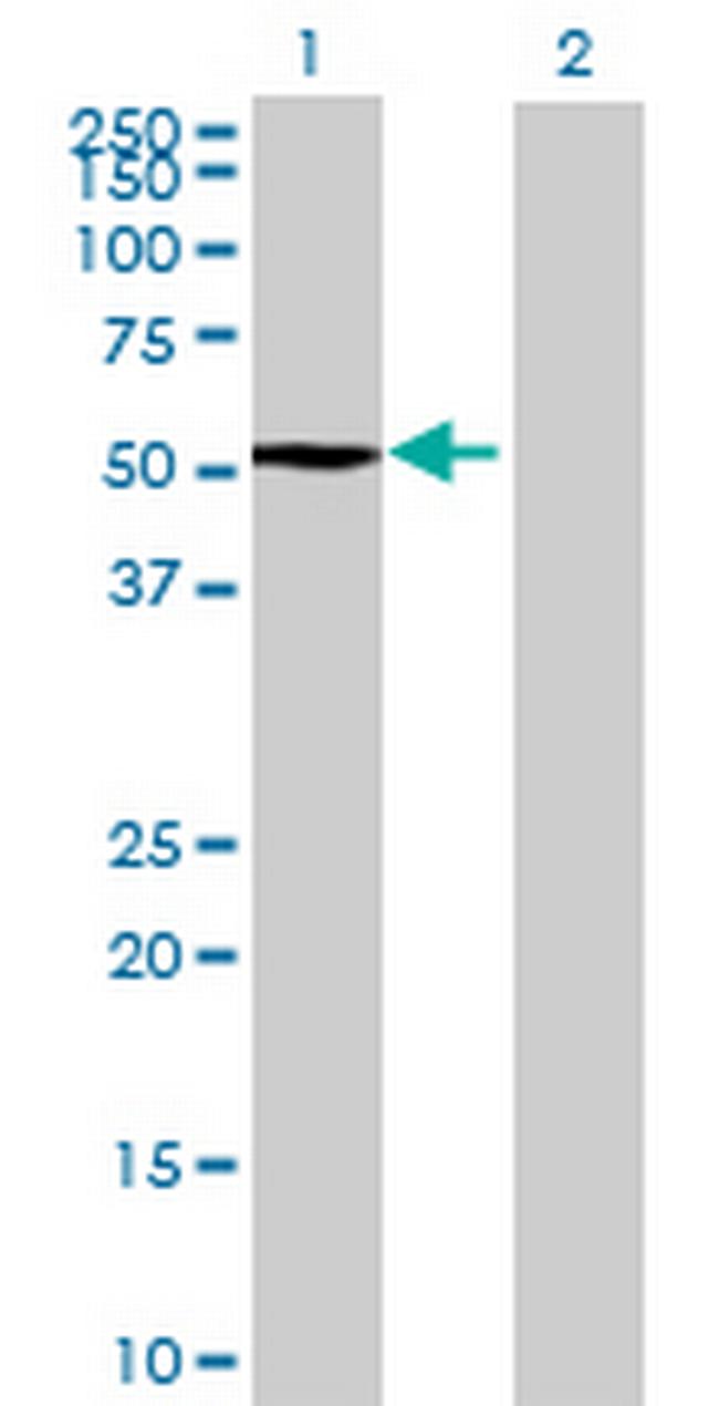 RBM34 Antibody in Western Blot (WB)