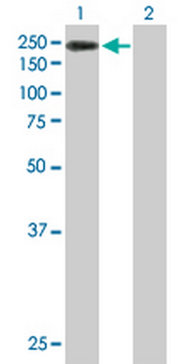 KDM4B Antibody in Western Blot (WB)