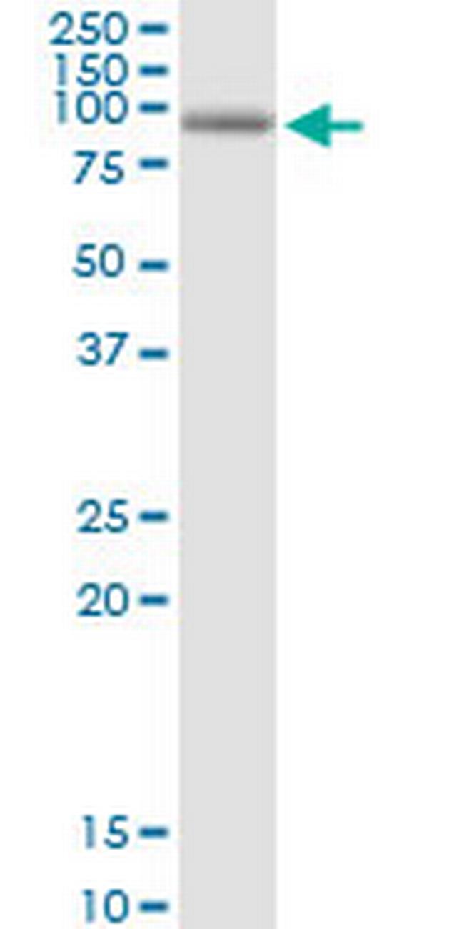 KIAA0251 Antibody in Western Blot (WB)