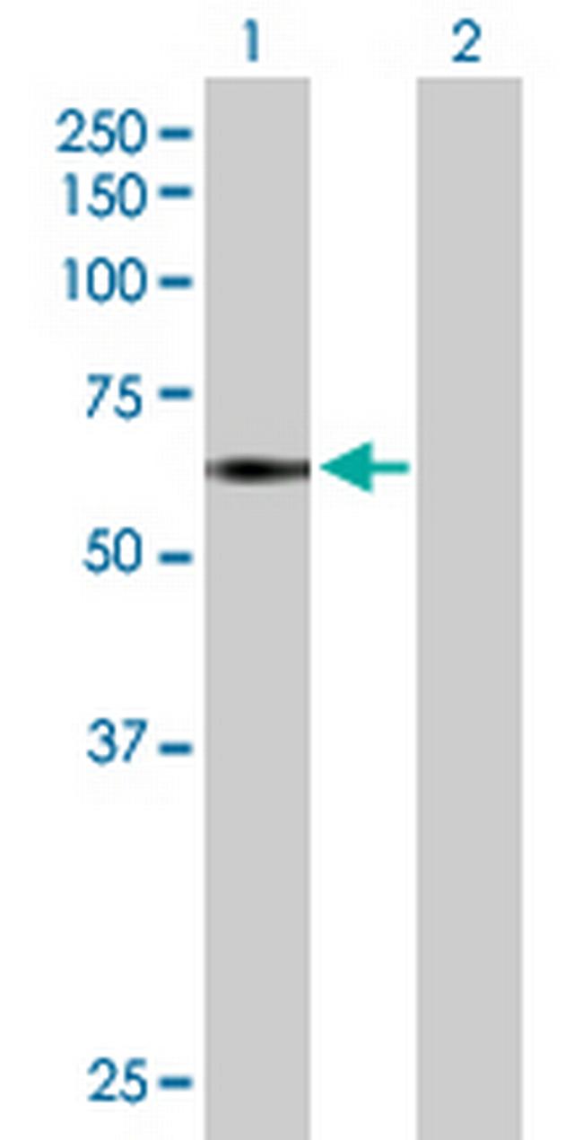 TNIK Antibody in Western Blot (WB)
