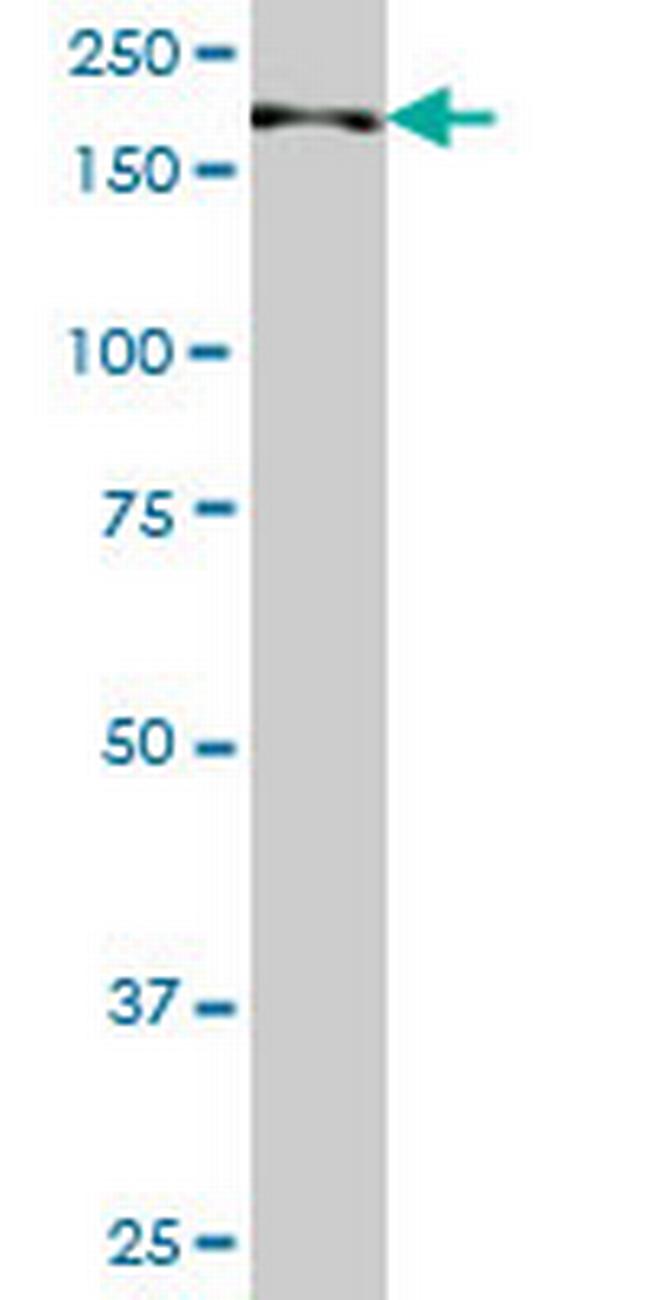 TNIK Antibody in Western Blot (WB)