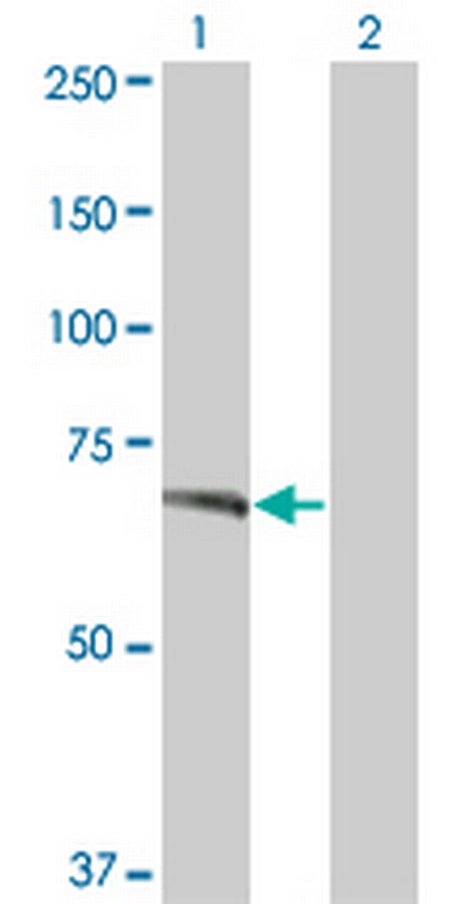 TNIK Antibody in Western Blot (WB)